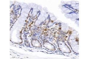 Immunohistochemistry analysis of paraffin-embedded mouse colon using,GINS2 (ABIN7074041) at dilution of 1: 3000 (GINS2 Antikörper)