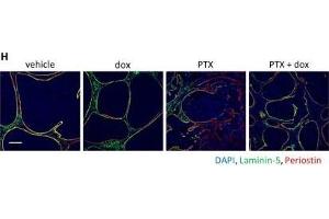 Immunofluorescence (Paraffin-embedded Sections) (IF (p)) image for anti-Periostin (POSTN) (C-Term) antibody (ABIN2854805)