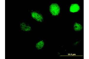 Immunofluorescence of purified MaxPab antibody to ALKBH on HeLa cell.
