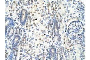 Image no. 1 for anti-Splicing Factor 1 (SF1) (N-Term) antibody (ABIN203234) (Splicing Factor 1 Antikörper  (N-Term))