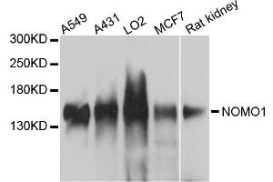 Western blot analysis of extracts of various cells, using NOMO1 antibody. (NOMO1 Antikörper)