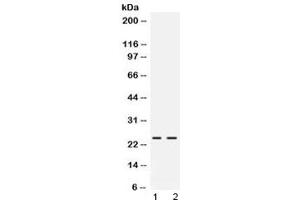 Western blot testing of rat 1) pancreas and 2) NRK lysate with FGF19 antibody at 0. (FGF19 Antikörper)