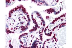 Anti-HMGB1 antibody IHC of human placenta. (HMGB1 Antikörper  (AA 1-216))