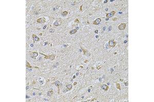 Immunohistochemistry of paraffin-embedded rat brain using FASTKD1 Antibody (ABIN5975129) at dilution of 1/100 (40x lens). (FASTKD1 Antikörper)