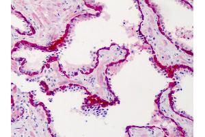 Anti-SLFN12 antibody IHC of human prostate. (SLFN12 Antikörper  (C-Term))