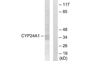 Western blot analysis of extracts from HUVEC cells, using Cytochrome P450 24A1 antibody. (CYP24A1 Antikörper  (C-Term))