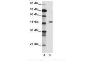 Image no. 1 for anti-Transcriptional Adaptor 3 (TADA3) (AA 156-205) antibody (ABIN6736087) (TADA3L Antikörper  (AA 156-205))