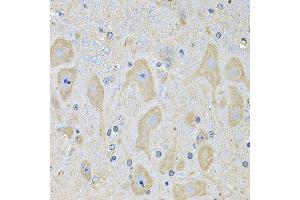 Immunohistochemistry of paraffin-embedded mouse brain using EPHA2 Antibody. (EPH Receptor A2 Antikörper  (AA 847-976))