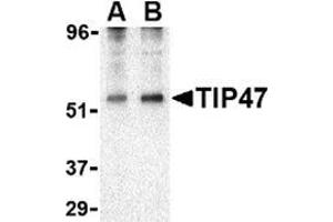 Western blot analysis of TIP47 in EL4 cell lysate with this product at (A) 0.