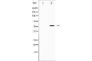 Western blot analysis of IRF3 expression in K562 whole cell lysates,The lane on the left is treated with the antigen-specific peptide. (IRF3 Antikörper  (C-Term))