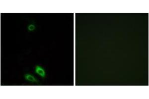 Immunofluorescence analysis of A549 cells, using AKR1CL1 Antibody. (AKR1CL1 Antikörper  (AA 80-129))
