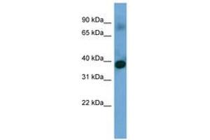 Image no. 1 for anti-Sideroflexin 4 (SFXN4) (N-Term) antibody (ABIN6745656) (Sideroflexin 4 Antikörper  (N-Term))