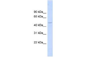 DBNL antibody used at 1 ug/ml to detect target protein. (DBNL Antikörper  (Middle Region))