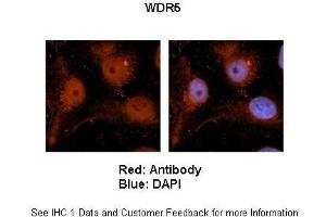 Sample Type :  Human brain stem cells (NT2)   Primary Antibody Dilution :   1:500  Secondary Antibody :  Goat anti-rabbit Alexa Fluor 594  Secondary Antibody Dilution :   1:1000  Color/Signal Descriptions :  Red: WDR5 Blue: DAPI  Gene Name :  WDR5  Submitted by :  Dr. (WDR5 Antikörper  (C-Term))