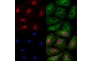 Phospho-SIRT6 (Thr294) Antibody staining A549 cells(4h of LPS treatment) by IF/ICC. (SIRT6 Antikörper  (pThr294))