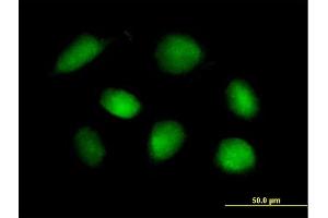 Immunofluorescence of purified MaxPab rabbit antibody to STK11 on HeLa cell. (LKB1 Antikörper  (AA 1-433))