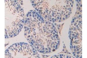 Immunohistochemistry (IHC) image for anti-Laminin, alpha 4 (LAMa4) (AA 457-630) antibody (ABIN7438160)