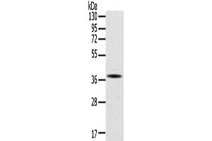 Western Blotting (WB) image for anti-Secreted Protein, Acidic, Cysteine-Rich (Osteonectin) (SPARC) antibody (ABIN2422187) (SPARC Antikörper)