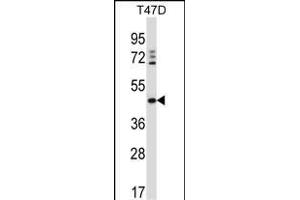 DEGS1 Antikörper  (N-Term)