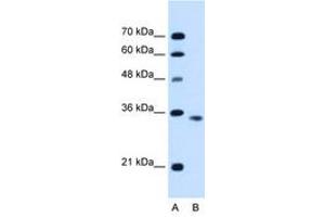 Image no. 1 for anti-Activin A Receptor, Type IIB (ACVR2B) (C-Term) antibody (ABIN6736679) (ACVR2B Antikörper  (C-Term))