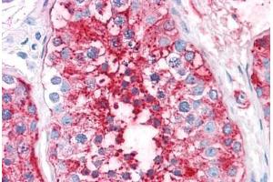 Human Testis: Formalin-Fixed, Paraffin-Embedded (FFPE) (ADAM20 Antikörper  (Internal Region))