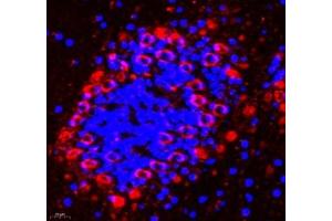 Immunofluorescence of paraffin embedded mouse epencephalon using AMIGO2 (ABIN7072966) at dilution of 1: 1300 (400x lens) (AMIGO2 Antikörper)