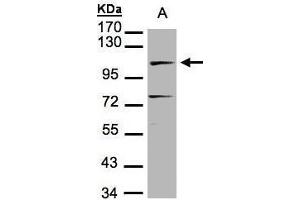 WB Image Sample(30 μg of whole cell lysate) A:MOLT4, 7. (LIG4 Antikörper)