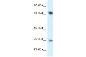 Western Blot showing SPC25 antibody used at a concentration of 1 ug/ml against 721_B Cell Lysate (SPC25 Antikörper  (Middle Region))