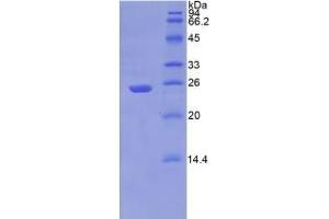 SDS-PAGE analysis of Human PSA Protein. (NPEPPS Protein)