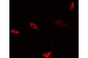 ABIN6274456 staining HT29 cells by IF/ICC. (DPF2 Antikörper  (Internal Region))