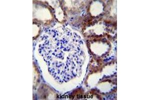 CASP3 Antibody (C-term) immunohistochemistry analysis in formalin fixed and paraffin embedded human kidney tissue followed by peroxidase conjugation of the secondary antibody and DAB staining. (Caspase 3 Antikörper  (C-Term))