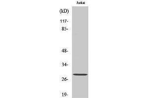 Western Blotting (WB) image for anti-Glutathione S-Transferase theta 1/4 (GSTT1/4) (N-Term) antibody (ABIN3184959) (GSTT1/4 Antikörper  (N-Term))