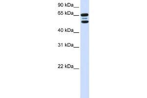 WB Suggested Anti-FBXO21 Antibody Titration:  0. (FBXO21 Antikörper  (N-Term))