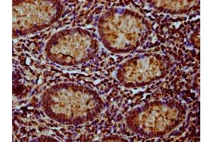 IHC image of ABIN7160882 diluted at 1:100 and staining in paraffin-embedded human appendix tissue performed on a Leica BondTM system. (NDUFAF3 Antikörper  (AA 91-184))