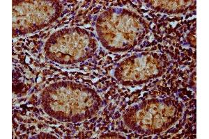 Immunohistochemistry (IHC) image for anti-NADH Dehydrogenase (Ubiquinone) Complex I, Assembly Factor 3 (NDUFAF3) (AA 91-184) antibody (ABIN7160882)