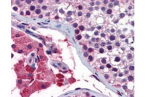 Immunohistochemistry (IHC) image for anti-Guanine Nucleotide Binding Protein (G Protein), Q Polypeptide (GNAQ) (AA 71-120) antibody (ABIN6747159)