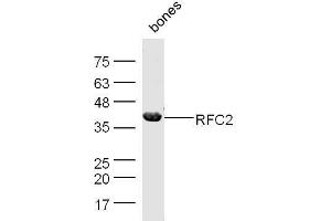Mouse bone lysates probed with Rabbit Anti-RFC2 Polyclonal Antibody, Unconjugated  at 1:500 for 90 min at 37˚C. (RFC2 Antikörper  (AA 281-354))