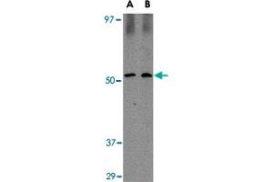 Western blot analysis of SIRT2 in Mouse brain tissue lysate with SIRT2 polyclonal antibody  at (A) 1 and (B) 2 ug/mL .