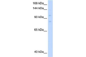 WB Suggested Anti-MCM8 Antibody Titration:  0. (MCM8 Antikörper  (C-Term))