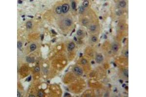 Used in DAB staining on fromalin fixed paraffin-embedded Liver tissue (IFNA2 Antikörper  (AA 24-188))