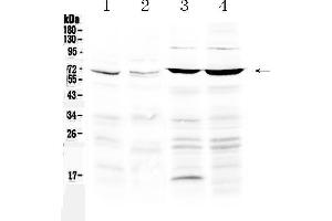 Western blot analysis of PPAR gamma using anti-PPAR gamma antibody . (PPARG Antikörper  (Middle Region))