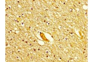 Immunohistochemistry (IHC) image for anti-Polymerase (DNA Directed), delta 1, Catalytic Subunit 125kDa (POLD1) (AA 1-123), (Catalytic Subunit) antibody (ABIN7150227)
