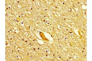 IHC image of ABIN7150227 diluted at 1:300 and staining in paraffin-embedded human brain tissue performed on a Leica BondTM system. (POLD1 Antikörper  (Catalytic Subunit))