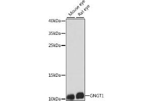 Western blot analysis of extracts of various cell lines, using GNGT1 antibody (ABIN7267288) at 1:1000 dilution.