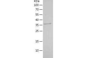 HSDL2 Protein (AA 212-363) (His-IF2DI Tag)