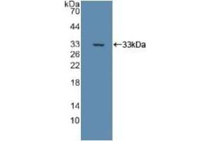Detection of Recombinant DLD, Rat using Polyclonal Antibody to Dihydrolipoyl Dehydrogenase (DLD) (DLD Antikörper)