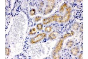 IHC testing of FFPE mouse kidney with CYP24A1 antibody. (CYP24A1 Antikörper  (AA 153-514))