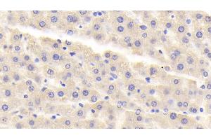 Detection of MAOA in Rat Liver Tissue using Polyclonal Antibody to Monoamine Oxidase A (MAOA) (Monoamine Oxidase A Antikörper  (AA 2-497))