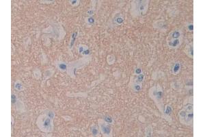 DAB staining on IHC-P; Samples: Human Cerebrum Tissue (RPN1 Antikörper  (AA 24-179))