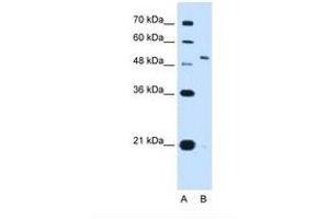 Image no. 1 for anti-Potassium Voltage-Gated Channel, Shaw-Related Subfamily, Member 1 (KCNC1) (AA 21-70) antibody (ABIN321117) (KCNC1 Antikörper  (AA 21-70))